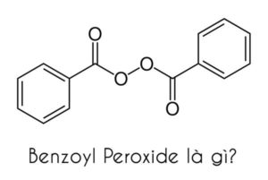 Trị mụn với benzoyl peroxide và những điều cần lưu ý – Tinh tế Beauty